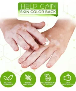 White Tag Treatment Moisturizing Cream,White Tag Treatment,Moisturizing Cream