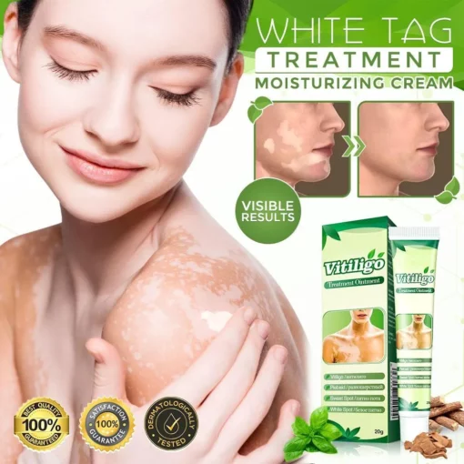 White Tag Treatment Moisturizing Cream, White Tag Treatment, Moisturizing Cream