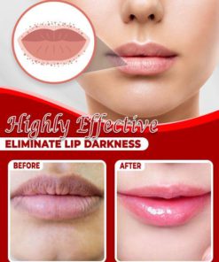 Dark Lip Blushing Balm,Lip Blushing Balm,Blushing Balm,Dark Lip Blushing,Dark Lip