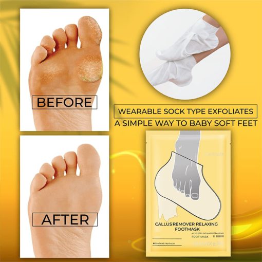 CallusRemover Relaxing FootMask