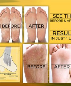 CallusRemover Relaxing FootMask