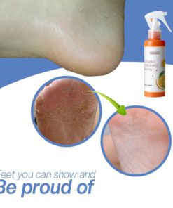 FootRevamp CallusRemoverSpray