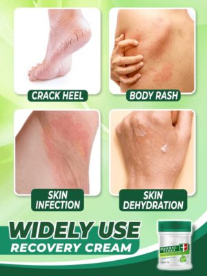Herbal Tinea Corporis Cream,Tinea Corporis Cream,Corporis Cream