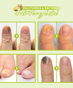 HealthyToe Anti-Fungal Gel,HealthyToe™ Anti-Fungal Gel,Anti-Fungal Gel