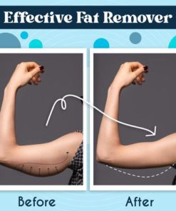 EMS Arm,Arm Shaper,Slimming™ EMS Arm Shaper