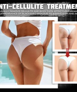 Slimming Cream,Body Slimming,BurnUp,BurnUp™ Body Slimming Cream