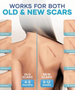 Vanish Scar Cream,Scar Cream