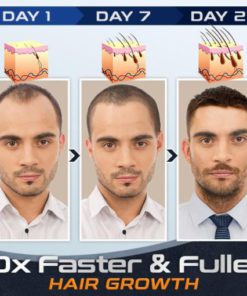 BioTech Advanced,Regrowth Treatment,Treatment Kit,Bio’Tech Advanced Regrowth Treatment Kit