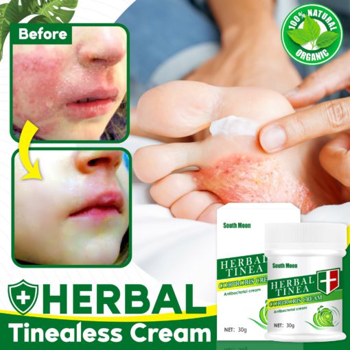 Tinea Cream, Herbal Tinealess Cream