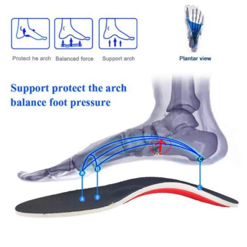 Branțuri pentru picior, Picior de susținere a arcului, Picior de susținere, Suport pentru arc, Branțuri pentru picioare de susținere a arcului