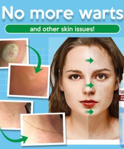 TagOff Skin Tag Remover