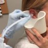 Ear Wax Removal Spray