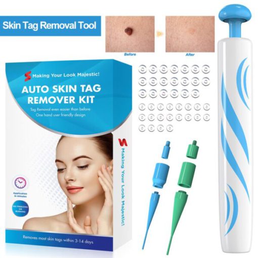 Skin Tag Removal Kit Online Best Price 2022 MOLOOCO