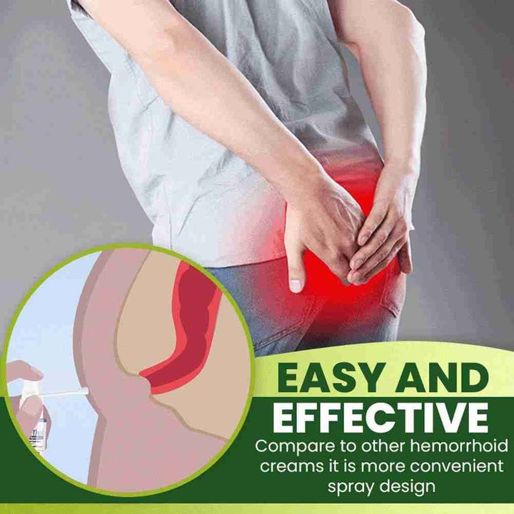 Hemorrhoid Spray,Herbal Hemorrhoid