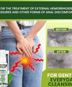 Hemorrhoid Spray,Herbal Hemorrhoid