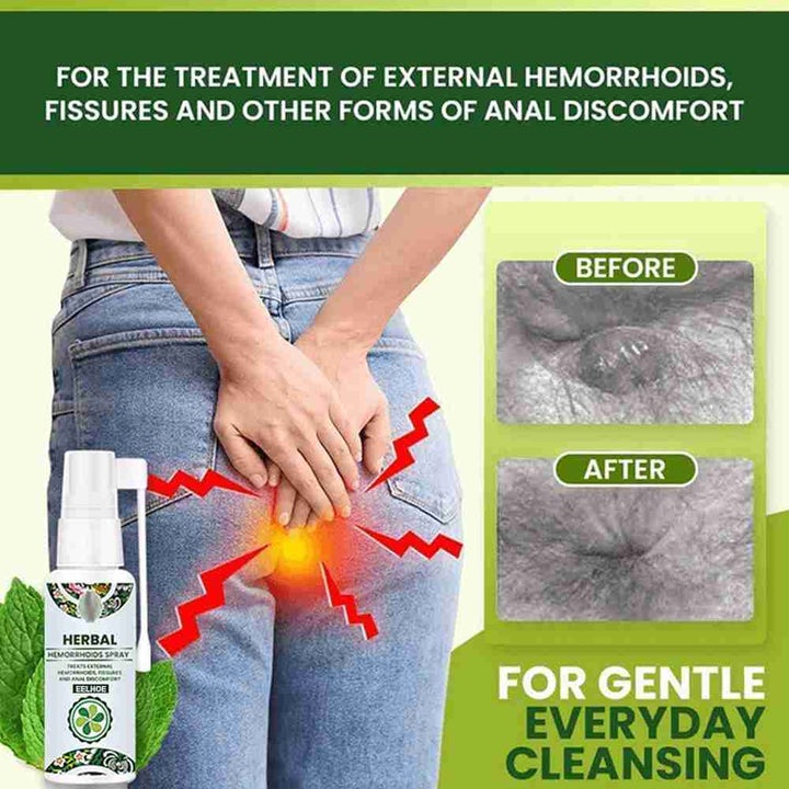 Hemorrhoid Spray,Herbal Hemorrhoid