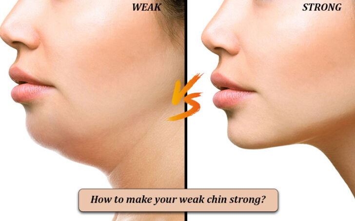 Weak Chin