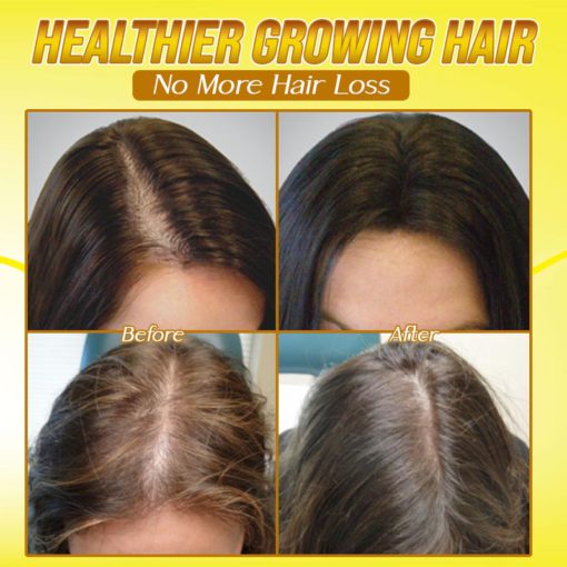Hair Growth Vitamin Serum Capsule