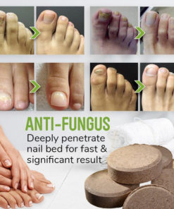 AntiFungal Foot Soak