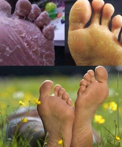 AntiFungal Foot Soak