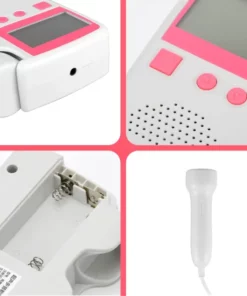 Prenatal Fetal Doppler