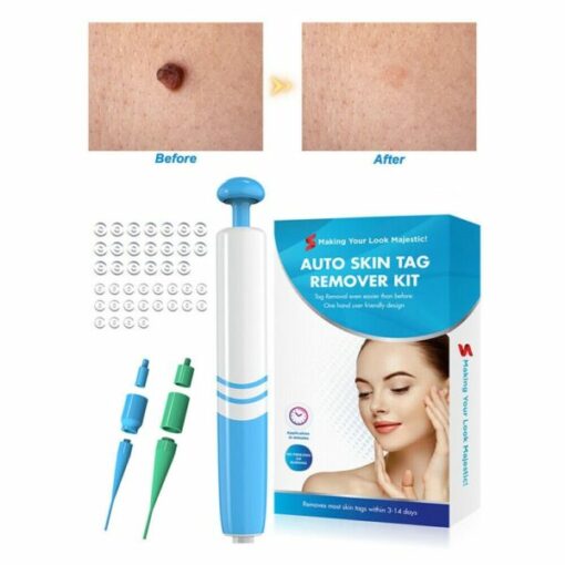 Auto Skin Tag Removal Kit Buy Today Get 55 Discount MOLOOCO
