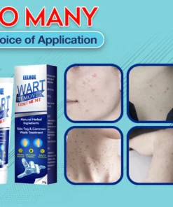 Instant Skin Tag Removal
