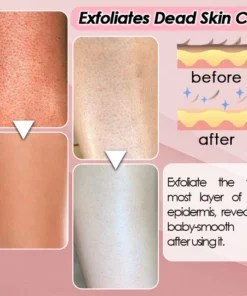 Silky Soft Skin Hair Remover