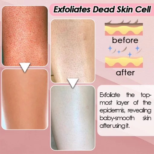 Silky Soft Skin Skin Remover