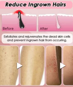 Silky Soft Skin Hair Remover