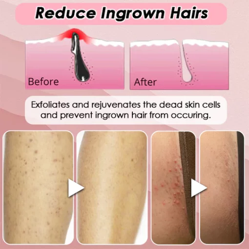 Silky Soft Skin Sredstvo za uklanjanje dlačica