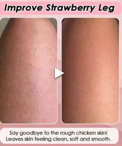 Silky Soft Skin Hair Remover