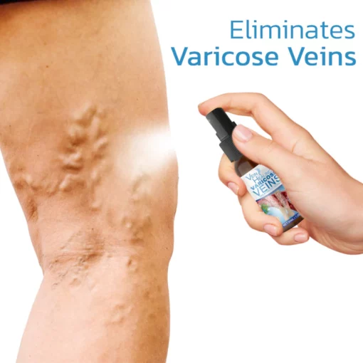 VeinHaart Varicose Veins Treatment Spray