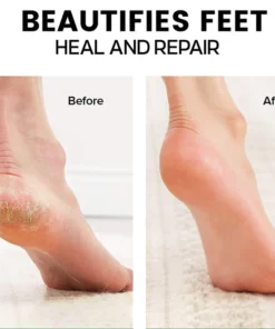 Intense Heel Moisturizing Stick