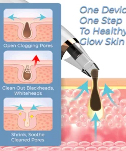 Pore Vacuum Cleaner For Blackheads