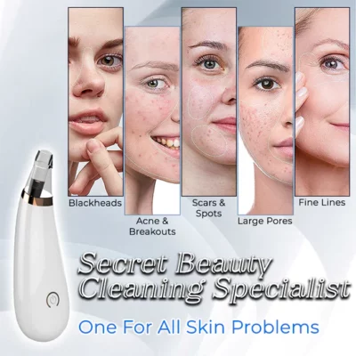 Pore Vacuum Cleaner For Blackheads