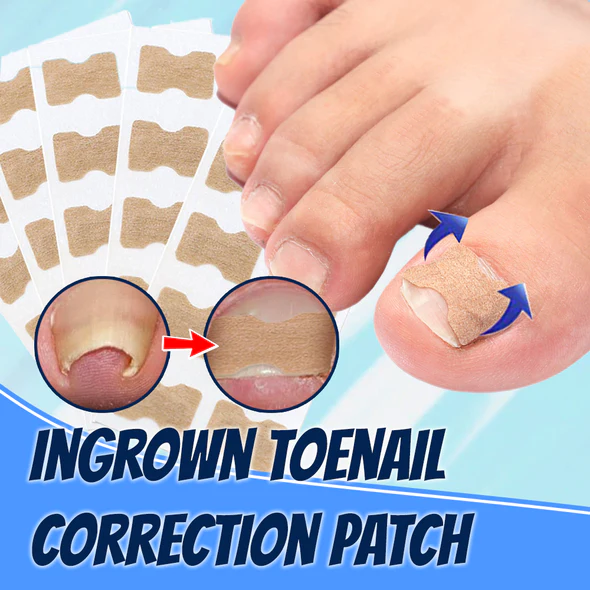 Ingrown Toenail Correction Patch Buy Today Get 55 Discount MOLOOCO
