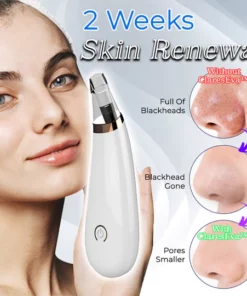 Pore Vacuum Cleaner For Blackheads