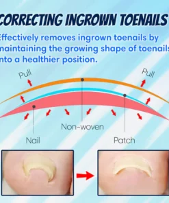 Ingrown Toenail Correction Patch