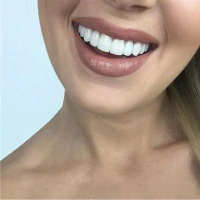 Adjustable Snap-On Dentures