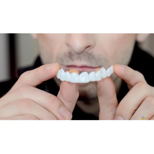 සකස් කළ හැකි Snap-On Dentures