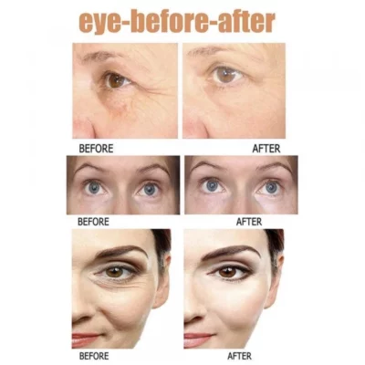 Wrinkle & Dark Circle Reducing Eye Serum