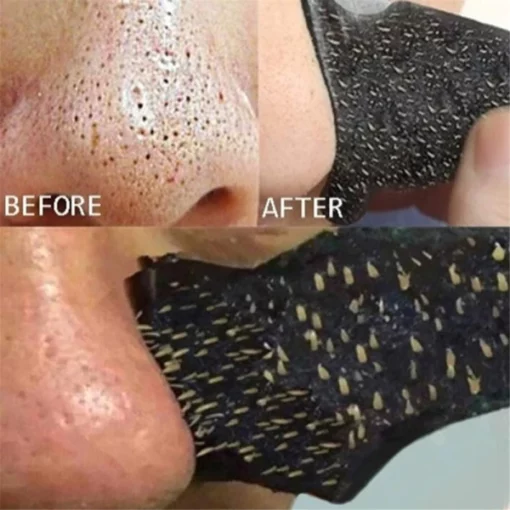 နှာခေါင်းမှ အမည်းစက်များကို ဖယ်ရှားသည့် စတစ်ကာအစင်းများ