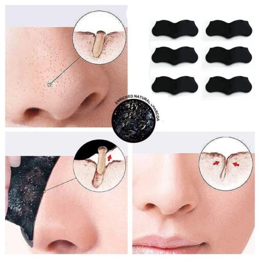 Trattamento per l'acne con maschera per il naso e rimozione di punti neri