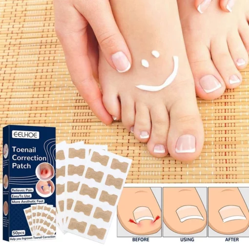 Пластир для корекції нігтів на ногах (30 упаковок)