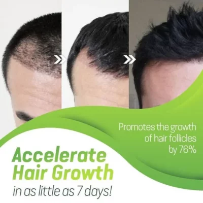 7X Rapid Hair Growth Serum