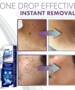 Instant Skin Tag Removal Mousse