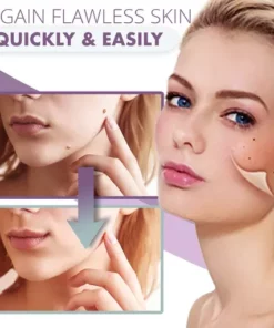 Instant Skin Tag Removal Mousse