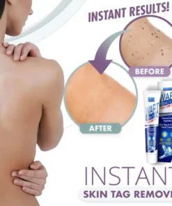 Instant Skin Tag Removal Mousse