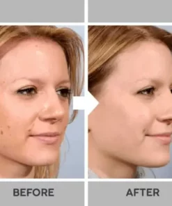 Instant Spots Removal Pen